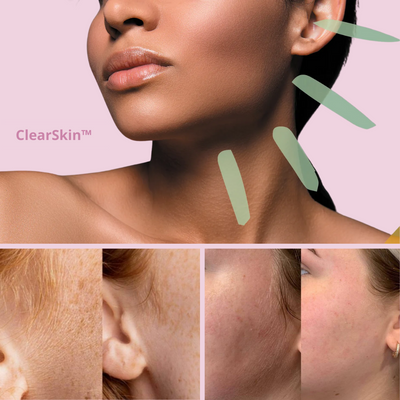 ClearSkin™ - Dermaplaning